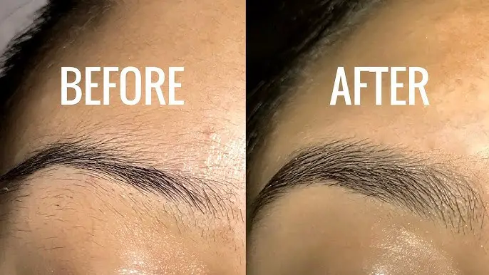 Can Eyebrow Hair Grow Back?: Before and After